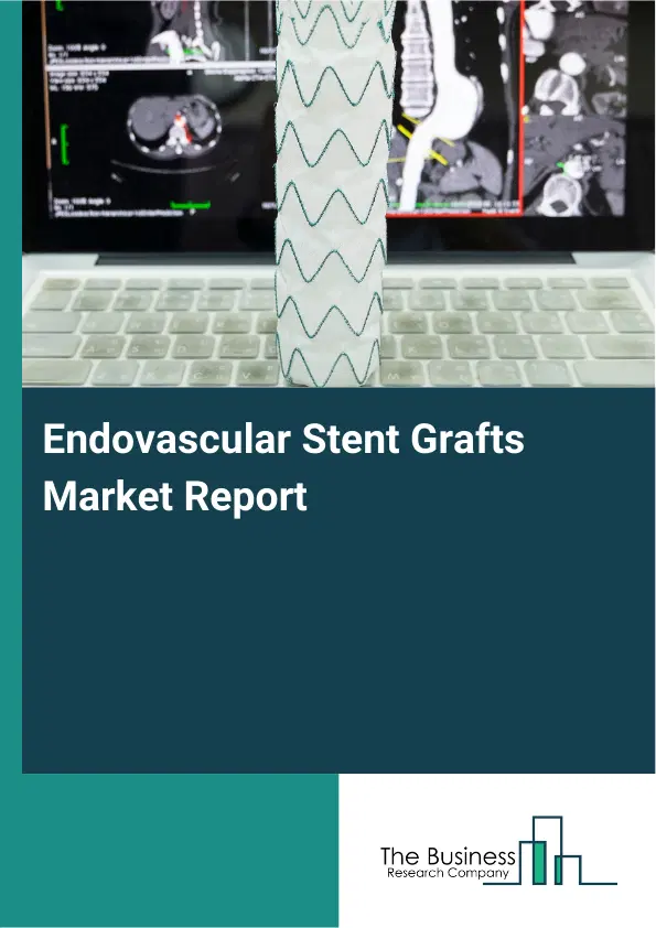 Endovascular Stent Grafts Market Report 2026 Endovascular Stent Grafts Market Report 2026