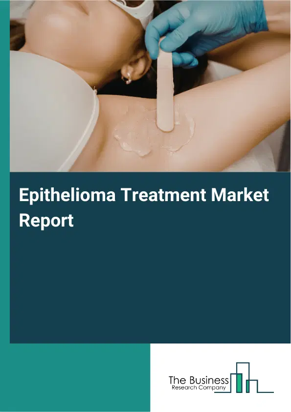 Epithelioma Treatment Market Report 2026 Epithelioma Treatment Market Report 2026