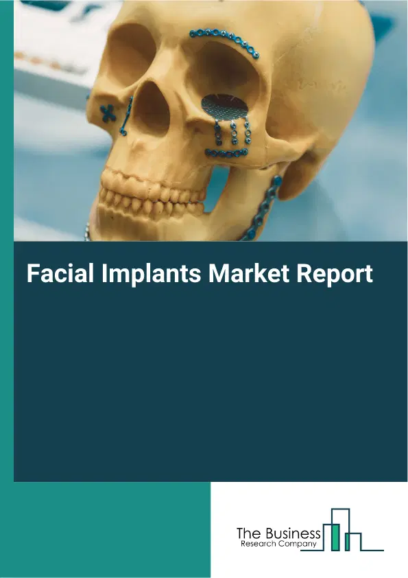 Facial Implants Market Report 2026 Facial Implants Market Report 2026