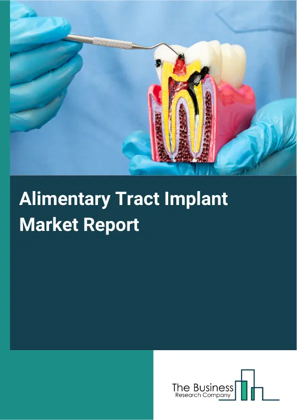 Alimentary Tract Implant Market Report 2026 Alimentary Tract Implant Market Report 2026