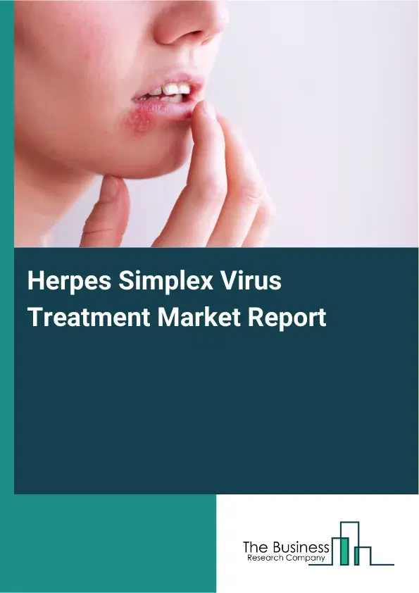 Global Herpes Simplex Virus Treatment Market Report 2026 Global Herpes Simplex Virus Treatment Market Report 2026