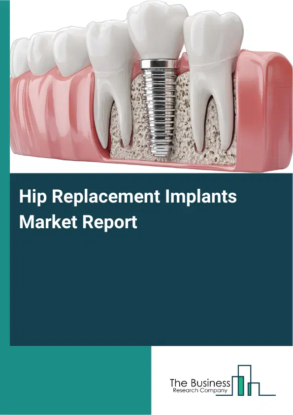 Global Hip Replacement Implants Market Report 2026 Global Hip Replacement Implants Market Report 2026