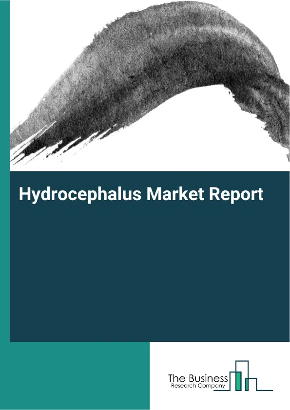 Global Hydrocephalus Market Report 2026 Global Hydrocephalus Market Report 2026
