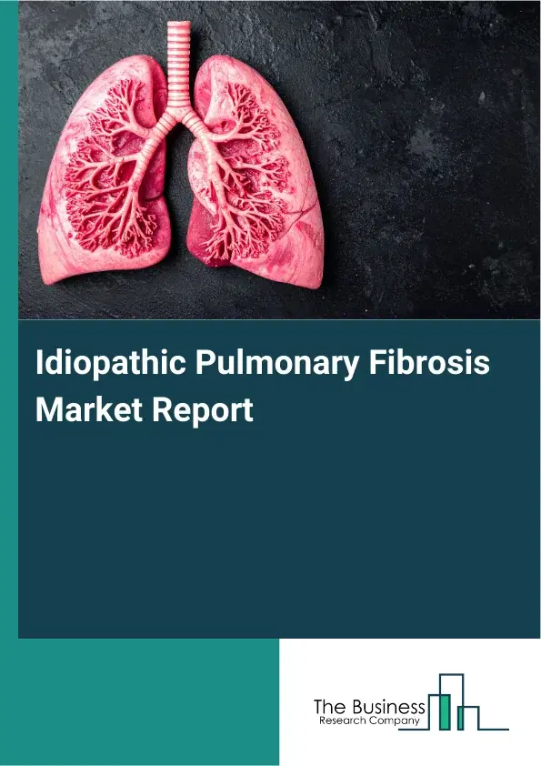 Global Idiopathic Pulmonary Fibrosis Market Report 2026 Global Idiopathic Pulmonary Fibrosis Market Report 2026