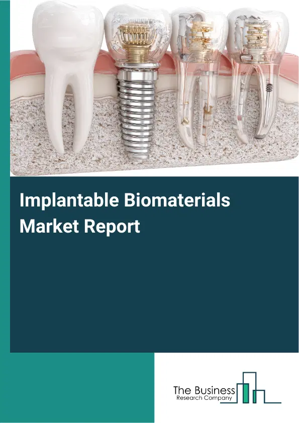 Global Implantable Biomaterials Market Report 2026 Global Implantable Biomaterials Market Report 2026