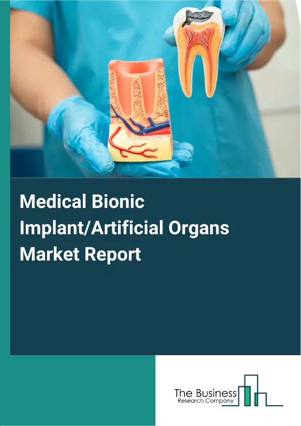 Medical Bionic Implant/Artificial Organs Market Report 2026 Medical Bionic Implant/Artificial Organs Market Report 2026