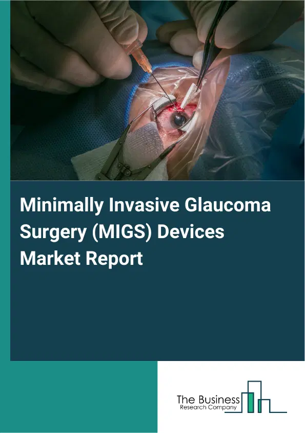 Global Minimally Invasive Glaucoma Surgery (MIGS) Devices Market Report 2026 Global Minimally Invasive Glaucoma Surgery (MIGS) Devices Market Report 2026