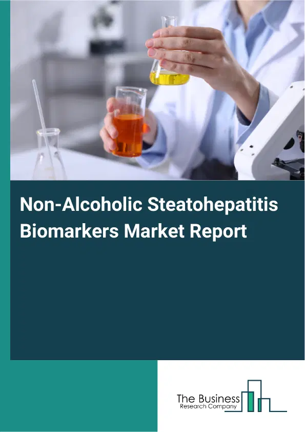 Global Non-Alcoholic Steatohepatitis Biomarkers Market Report 2026 Global Non-Alcoholic Steatohepatitis Biomarkers Market Report 2026