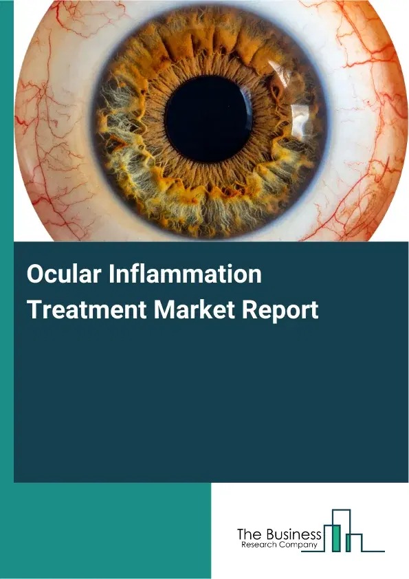 Global Ocular Inflammation Treatment Market Report 2026 Global Ocular Inflammation Treatment Market Report 2026
