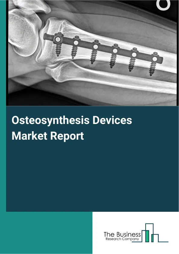 Osteosynthesis Devices Market Report 2026 Osteosynthesis Devices Market Report 2026