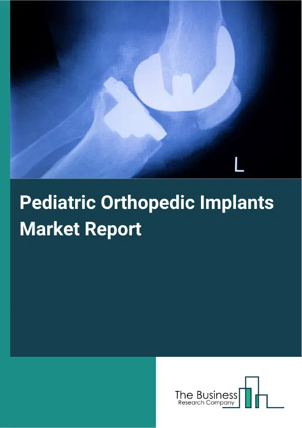 Pediatric Orthopedic Implants Market Report 2026 Pediatric Orthopedic Implants Market Report 2026