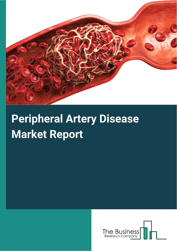 Global Peripheral Artery Disease Market Report 2026 Global Peripheral Artery Disease Market Report 2026