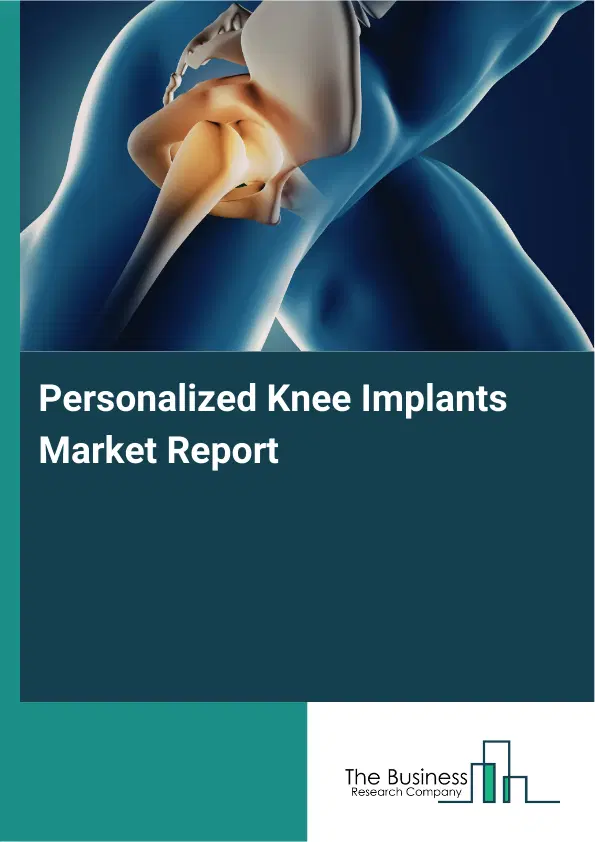 Personalized Knee Implants Market Report 2026 Personalized Knee Implants Market Report 2026