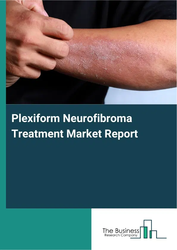 Plexiform Neurofibroma Treatment Market Report 2026 Plexiform Neurofibroma Treatment Market Report 2026