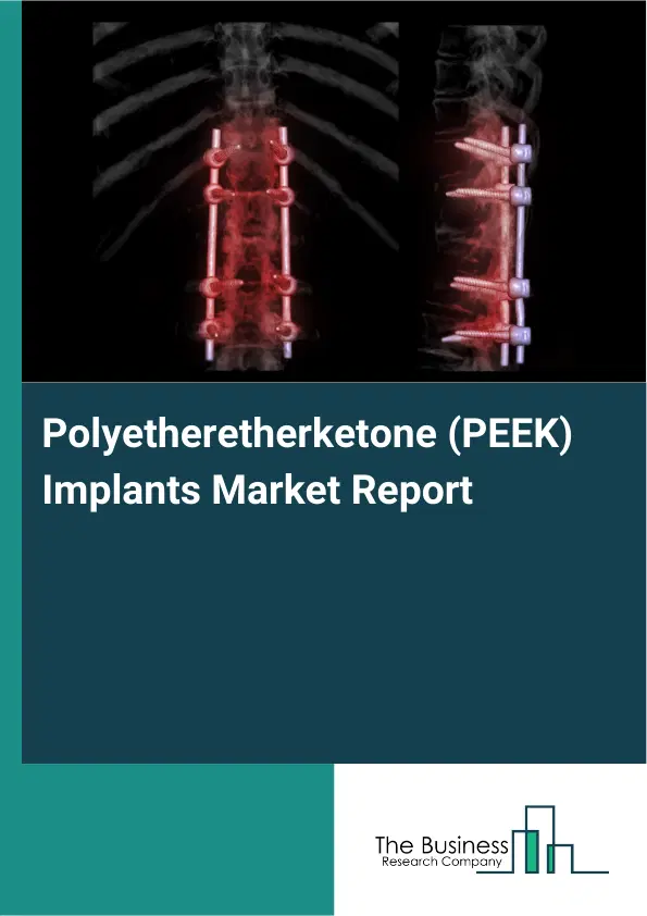 Polyetheretherketone (PEEK) Implants Market Report 2026 Polyetheretherketone (PEEK) Implants Market Report 2026