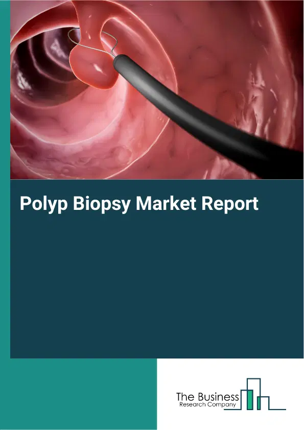 Polyp Biopsy Market Report 2026 Polyp Biopsy Market Report 2026