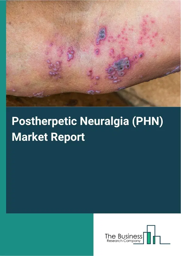 Postherpetic Neuralgia (PHN) Market Report 2026 Postherpetic Neuralgia (PHN) Market Report 2026