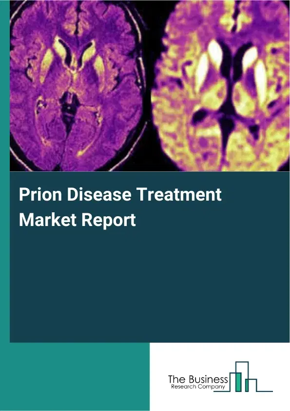 Prion Disease Treatment Market Report 2026 Prion Disease Treatment Market Report 2026