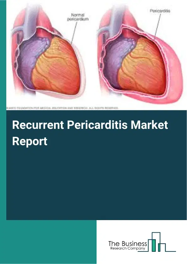 Recurrent Pericarditis Market Report 2026 Recurrent Pericarditis Market Report 2026