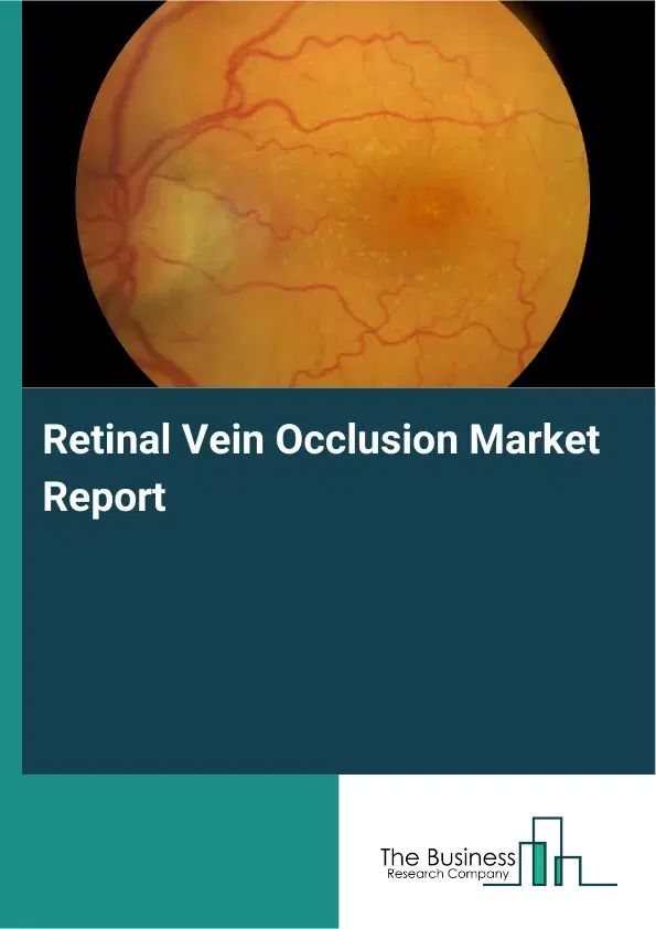 Global Retinal Vein Occlusion Market Report 2026 Global Retinal Vein Occlusion Market Report 2026