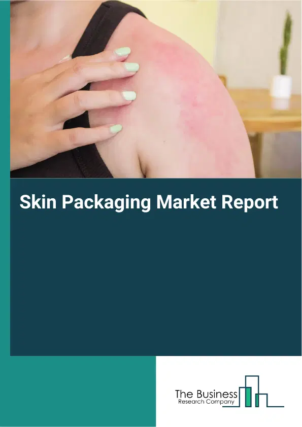 Skin Packaging Market Report 2026 Skin Packaging Market Report 2026