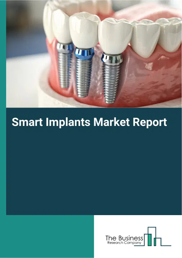 Smart Implants Market Report 2026 Smart Implants Market Report 2026