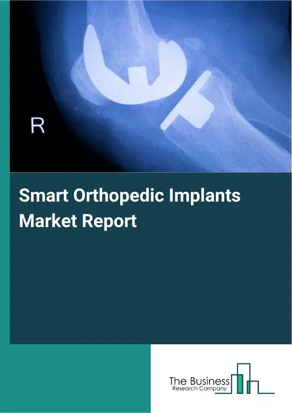 Smart Orthopedic Implants Market Report 2026 Smart Orthopedic Implants Market Report 2026