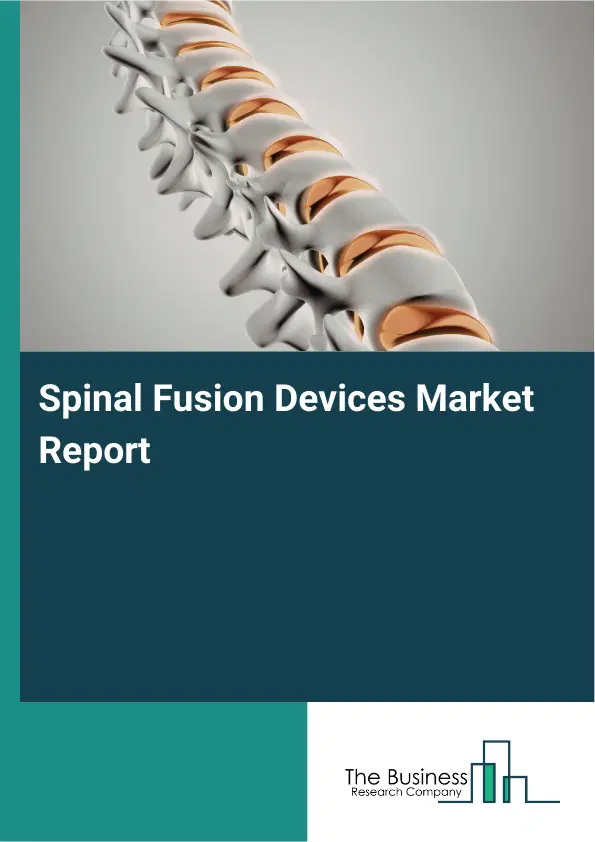 Spinal Fusion Devices Market Report 2026 Spinal Fusion Devices Market Report 2026