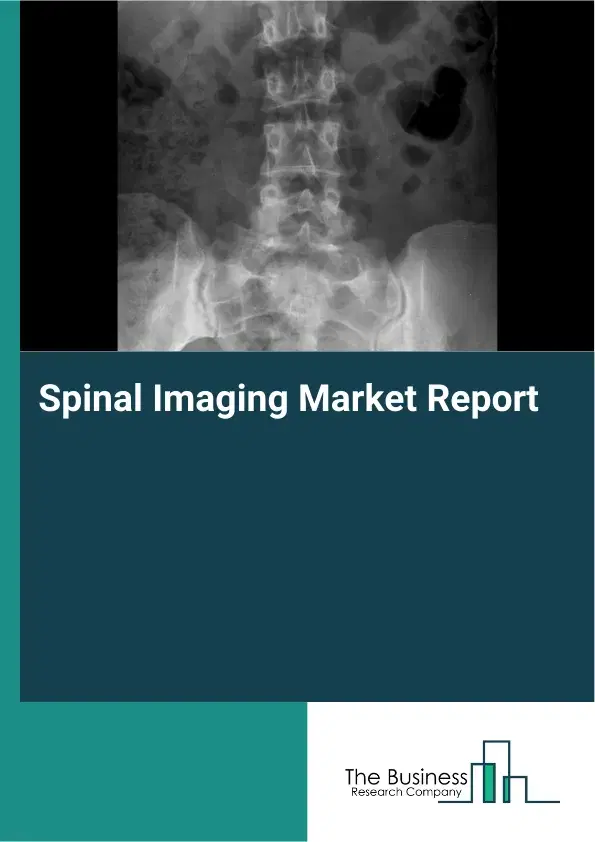 Global Spinal Imaging Market Report 2026 Global Spinal Imaging Market Report 2026