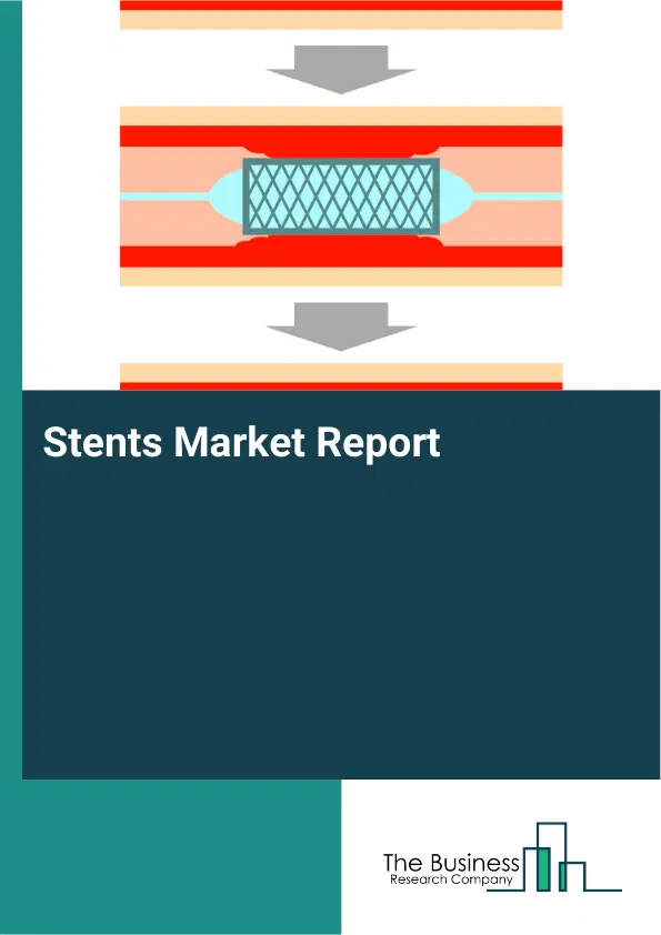 Stents Market Report 2026 Stents Market Report 2026