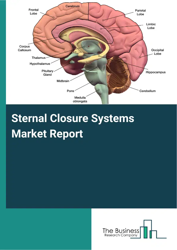 Sternal Closure Systems Market Report 2026 Sternal Closure Systems Market Report 2026