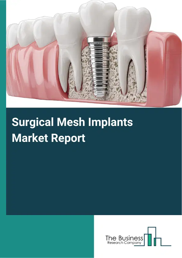 Surgical Mesh Implants Market Report 2026 Surgical Mesh Implants Market Report 2026