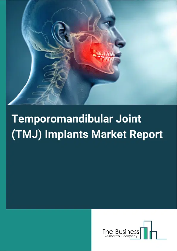 Temporomandibular Joint (TMJ) Implants Market Report 2026 Temporomandibular Joint (TMJ) Implants Market Report 2026