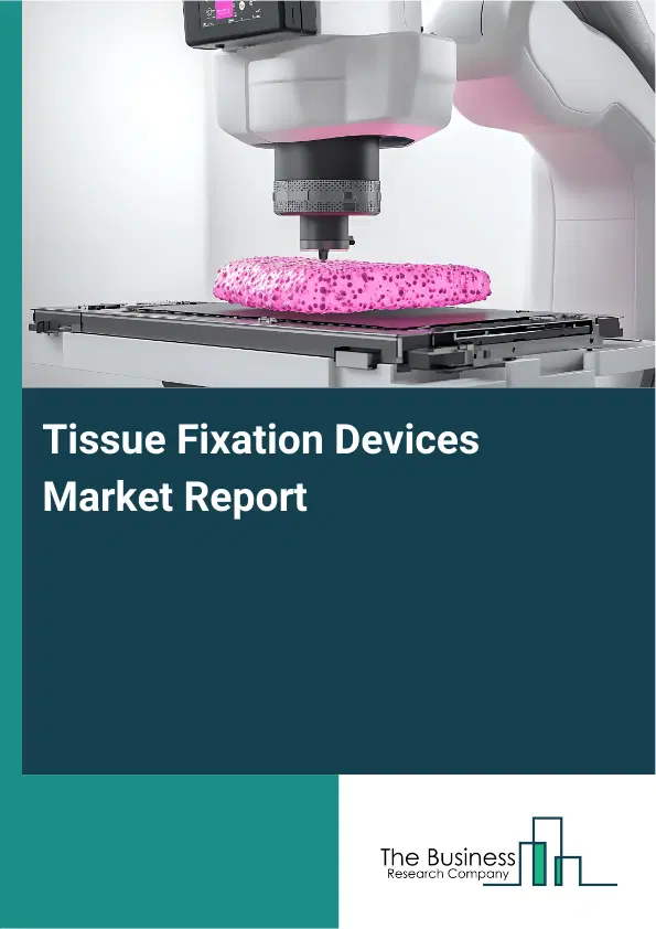 Tissue Fixation Devices Market Report 2026 Tissue Fixation Devices Market Report 2026