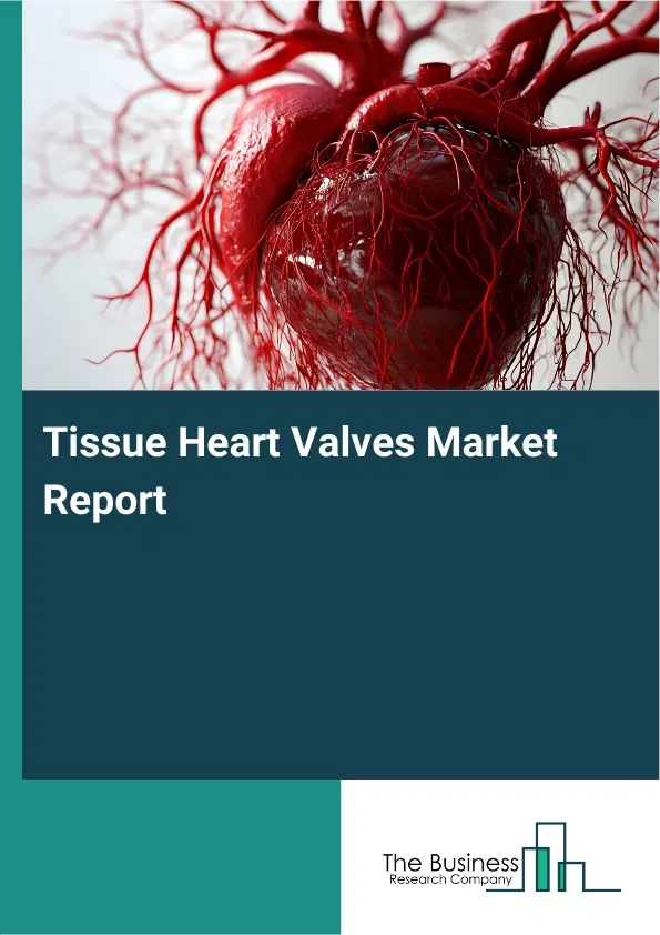 Tissue Heart Valves Market Report 2026 Tissue Heart Valves Market Report 2026