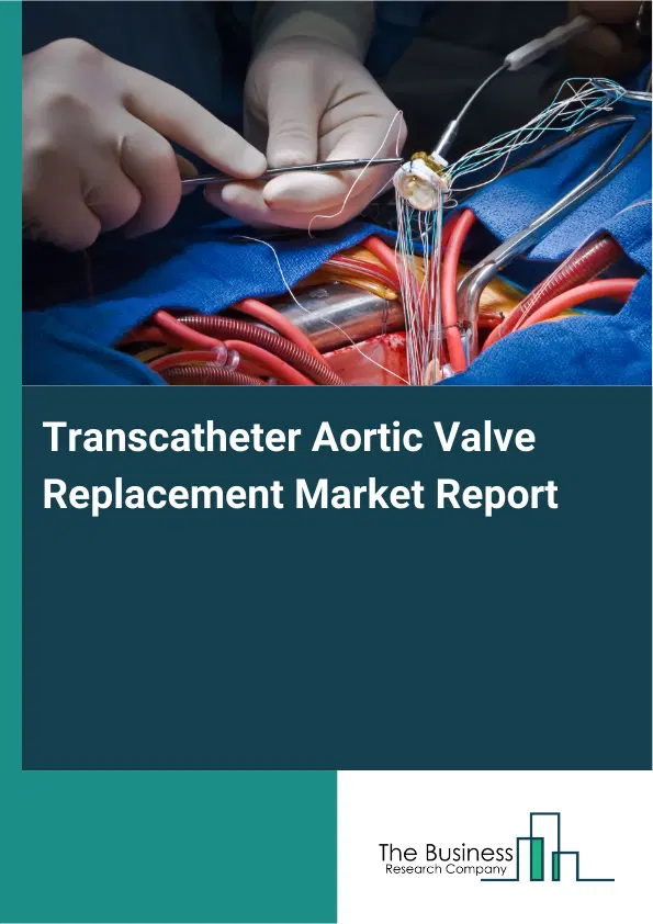 Global Transcatheter Aortic Valve Replacement Market Report 2026 Global Transcatheter Aortic Valve Replacement Market Report 2026