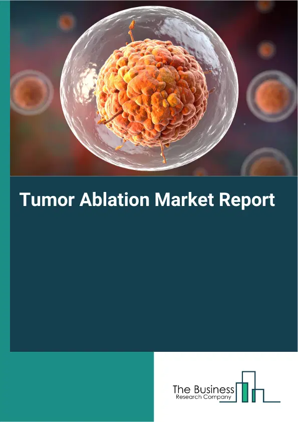 Tumor Ablation Market Report 2026 Tumor Ablation Market Report 2026