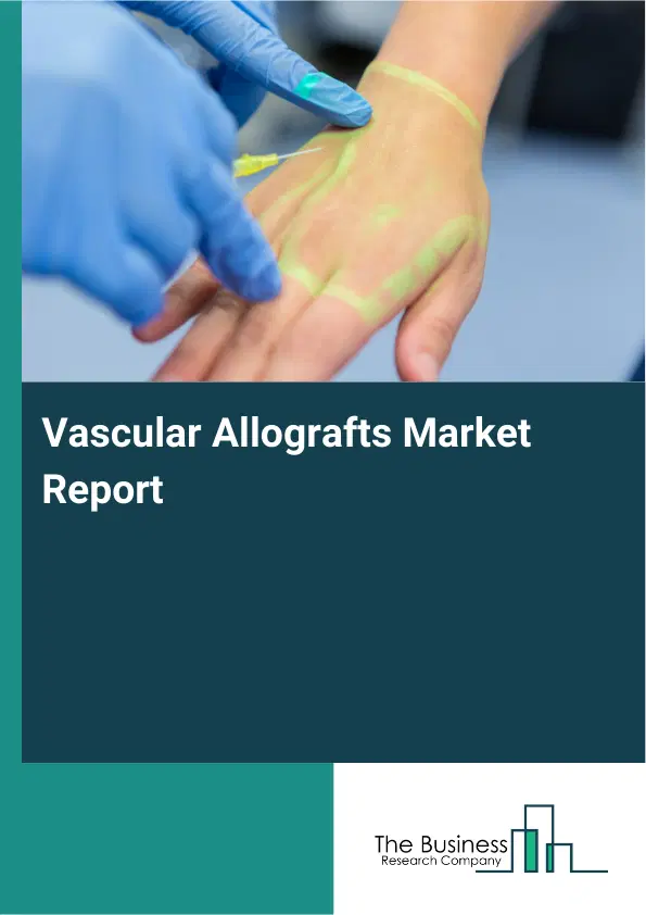 Vascular Allografts Market Report 2026 Vascular Allografts Market Report 2026