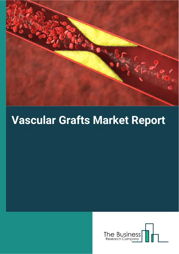 Global Vascular Grafts Market Report 2026 Global Vascular Grafts Market Report 2026