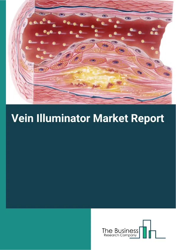 Global Vein Illuminator Market Report 2026 Global Vein Illuminator Market Report 2026