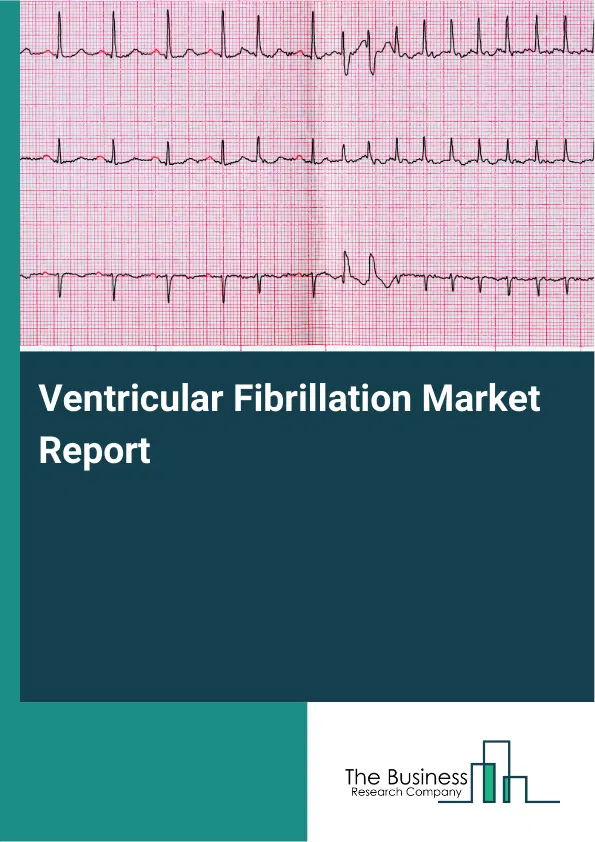 Ventricular Fibrillation Market Report 2026 Ventricular Fibrillation Market Report 2026
