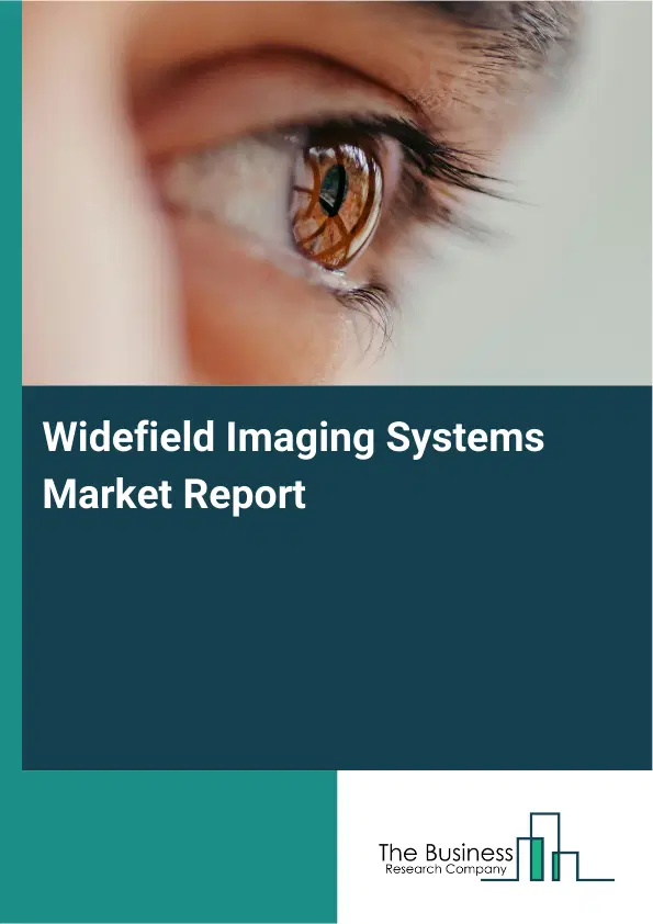 Widefield Imaging Systems Market Report 2026 Widefield Imaging Systems Market Report 2026
