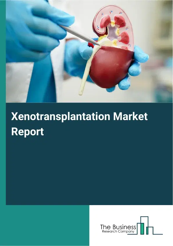 Global Xenotransplantation Market Report 2026 Global Xenotransplantation Market Report 2026