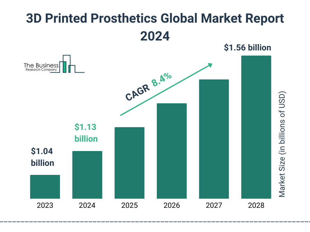 Global 3D Printed Prosthetics Market Size 2023 to 2028: Graph