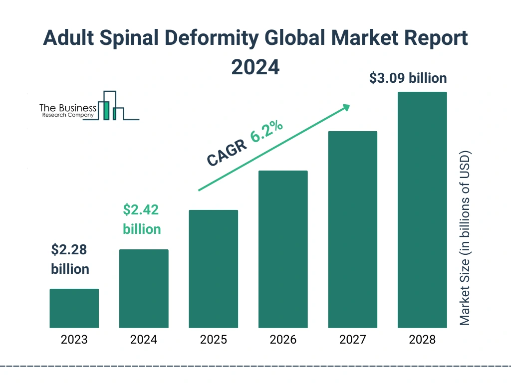 Global Adult Spinal Deformity Market Size 2023 to 2028: Graph