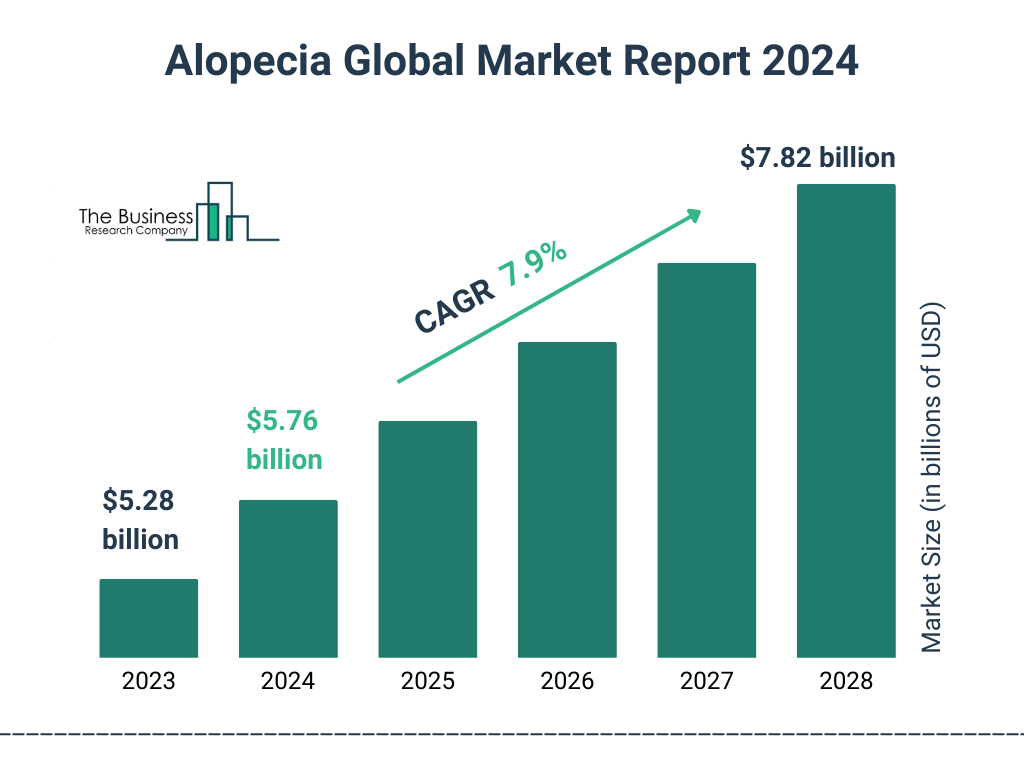 Global Alopecia Market Size 2023 to 2028: Graph