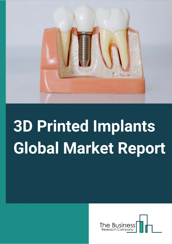 3D Printed Implants