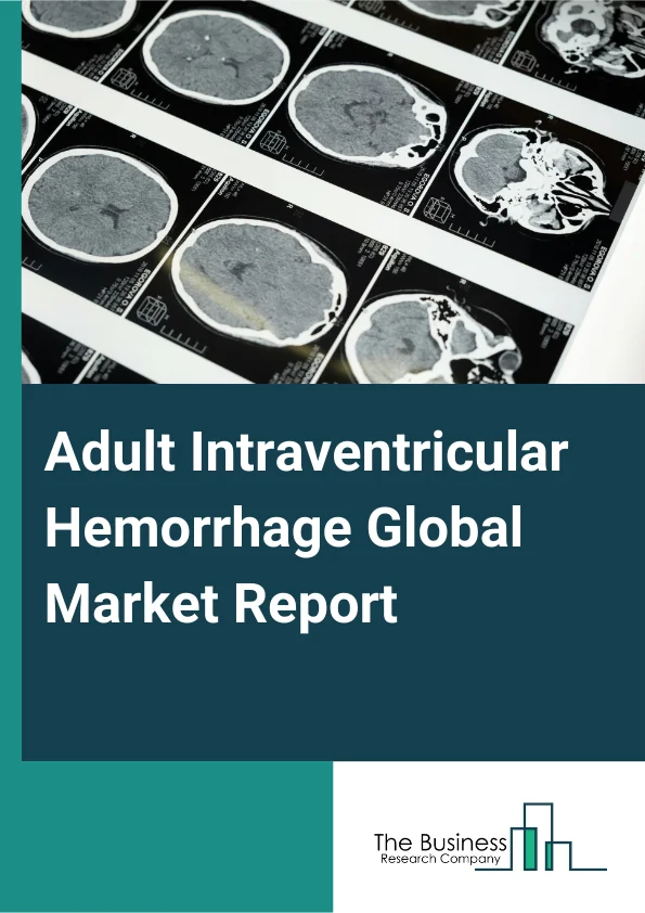 Adult Intraventricular Hemorrhage