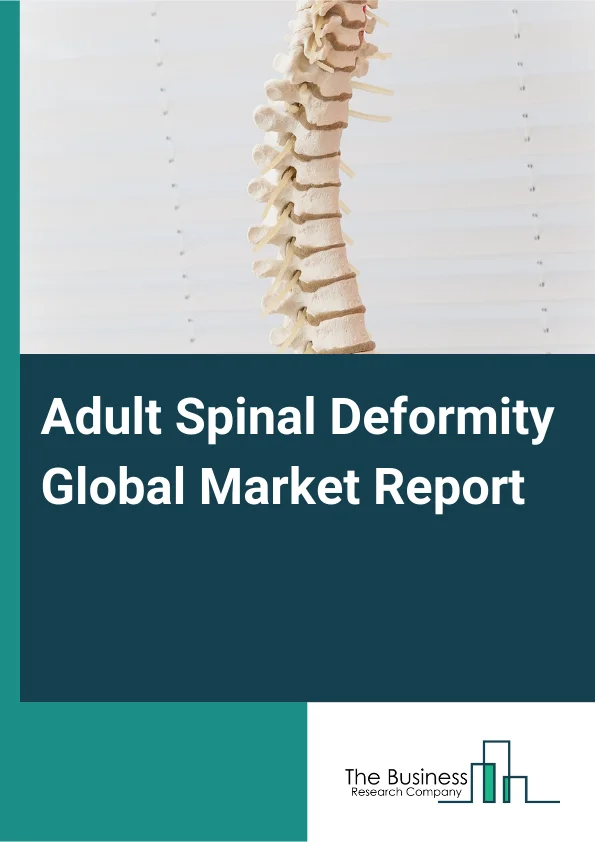 Adult Spinal Deformity