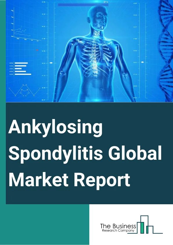 Global Ankylosing Spondylitis Market Report 2024